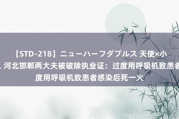 【STD-218】ニューハーフダブルス 天使×小悪魔 沙織 もえ 河北邯郸两大夫被破除执业证：过度用呼吸机致患者感染后死一火